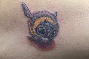 , Laser Tattoo Removal in San Antonio
